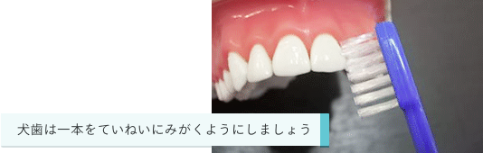 犬歯は一本をていねいにみがくようにしましょう