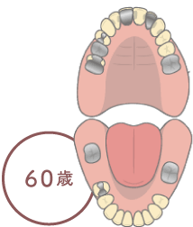 60歳