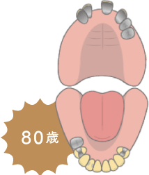 80歳