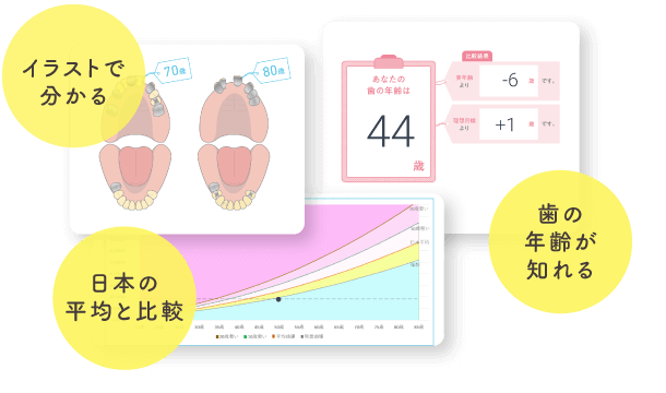 イラストで分かる、歯の年齢が知れる、日本の平均と比較