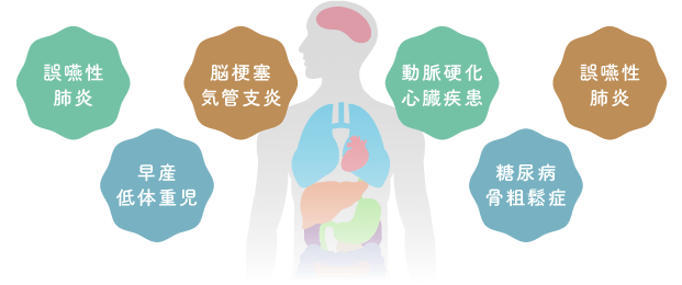 誤嚥性肺炎、早産低体重児、脳梗塞気管支炎、動脈硬化心臓疾患、糖尿病骨粗鬆症、誤嚥性肺炎